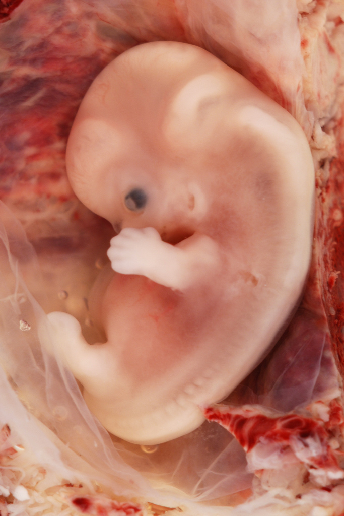 fetus at 6 weeks. 7 weeks after conception):