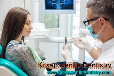 Dental Crowns Silverdale WA