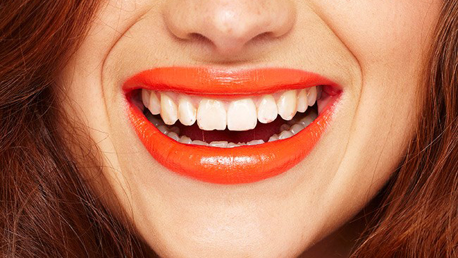 How To Get White Teeth ?