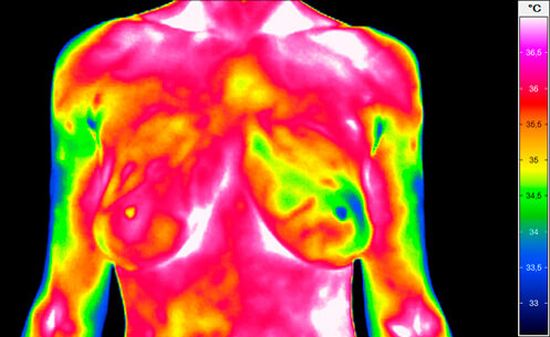 Infrared Thermography Is Safe And Ideal For Detection Of Major Diseases