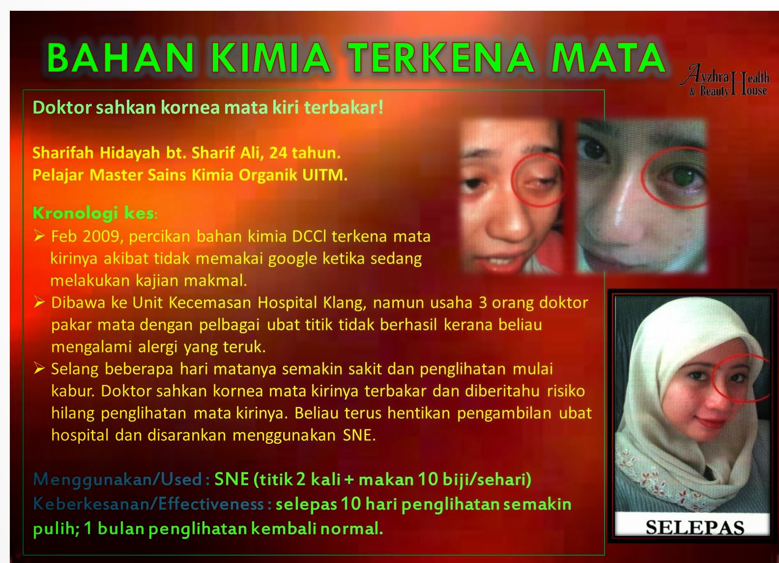 Ubat Hilangkan Parut Kekal - Pertanyaan o