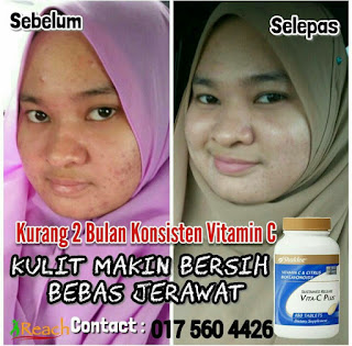 Bagus sangat ke Shaklee? 