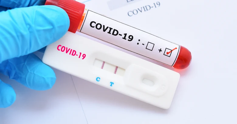 Testes de Covid-19 leva a população ser criminosa, por isso é obrigada a tomar um tiro de vacina