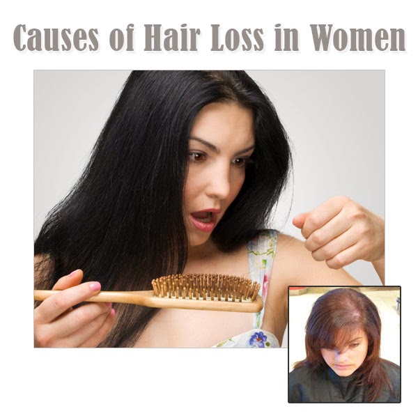Causes Of Hair Loss In Women