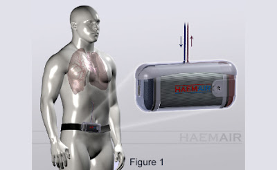 Haemair Hopes to Get Human a Respiratory Aid and Prosthetic Lung