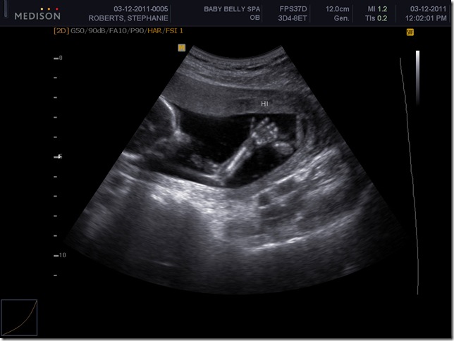 BABY BOY ROBERTS_0008