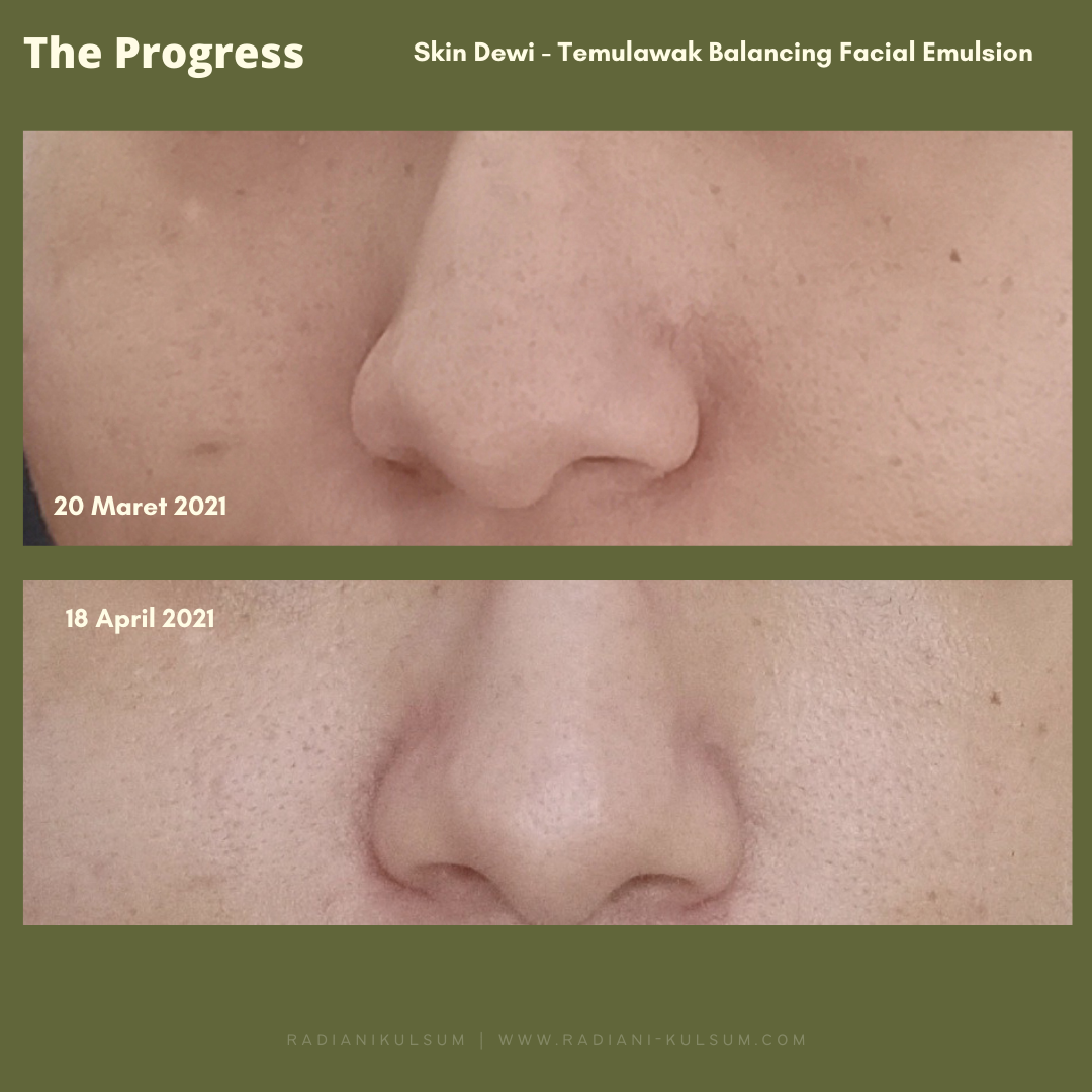 Progress Skin Dewi Temulawak Balancing Facial Emulsion