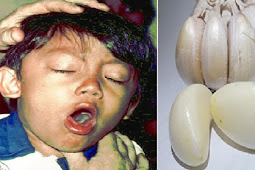 Anak Batuk Terus-terusan? Ternyata Bawang Putih Bisa Meredakan Batuk, Lebih Mujarab dari Obat Warung! 