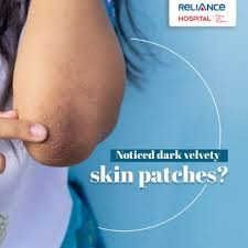 Dark, velvety patches on skin: