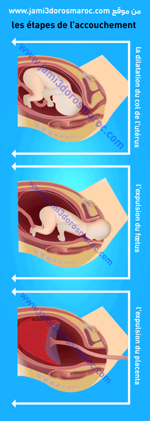 l’accouchement