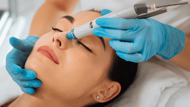 top-hydrafacial-provider-for-acne-treatments-barbies-beauty-bits