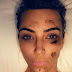 Kim Kardashian shares account of living with psoriasis (photos) 