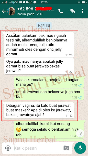 Cara Cepat Menghilangkan Jerawat di Miss V / Vagina Secara Alami