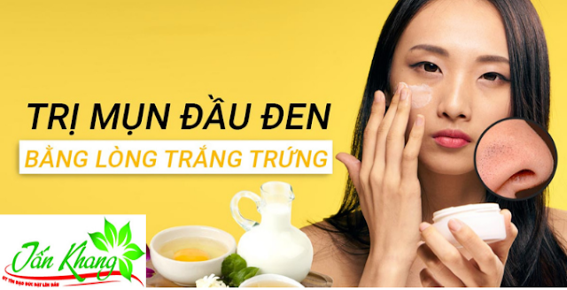 hướng dẫn 7 cách trị mụn đầu đen bằng lòng trắng trứng gà hot nhất