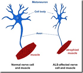 ALS1