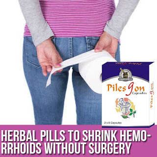 Shrink Hemorrhoids Without Surgery