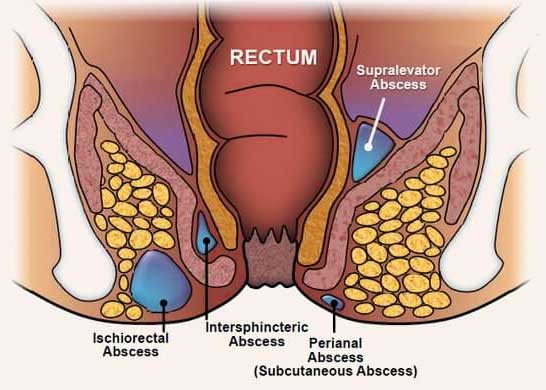 anus