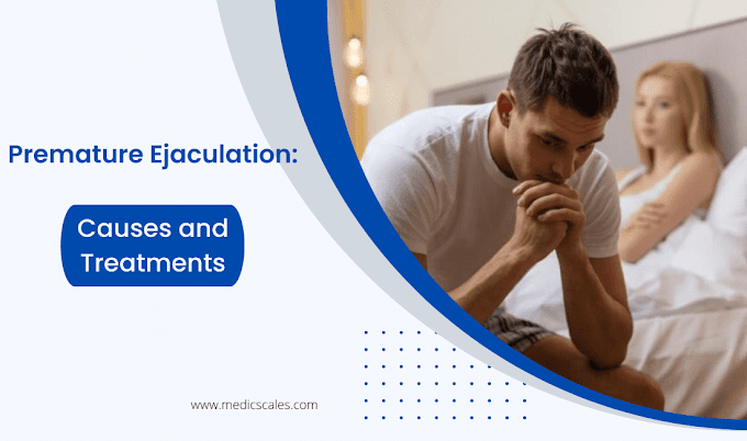 Treatment of premature ejaculation