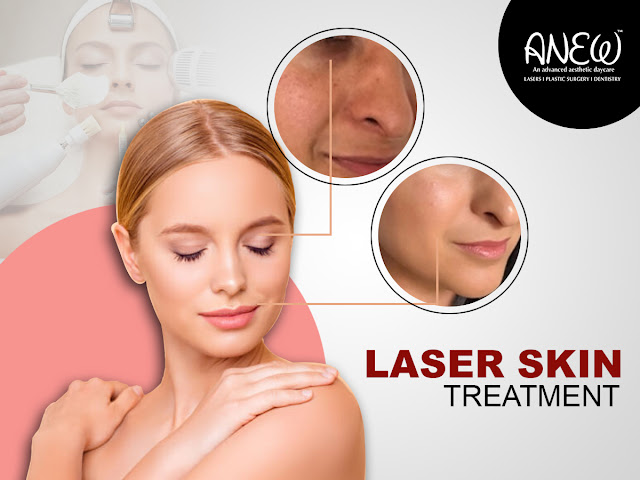 Laser Skin Treatment Bangalore