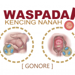 Nama Obat Apotik Menyembuhkan Kencing Nanah