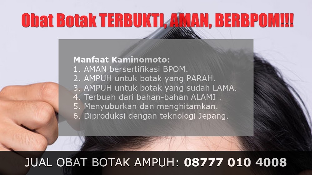 CARA MENUMBUHKAN RAMBUT AKIBAT TRIKOTILOMANIA<br/>Sambas<br/>