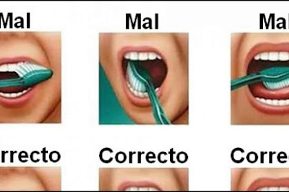 Como Es La Forma Correcta De Cepillarse Los Dientes