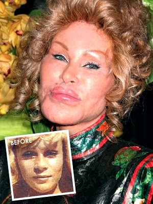 jocelyn wildenstein before surgery. Jocelyn+wildenstein+efore