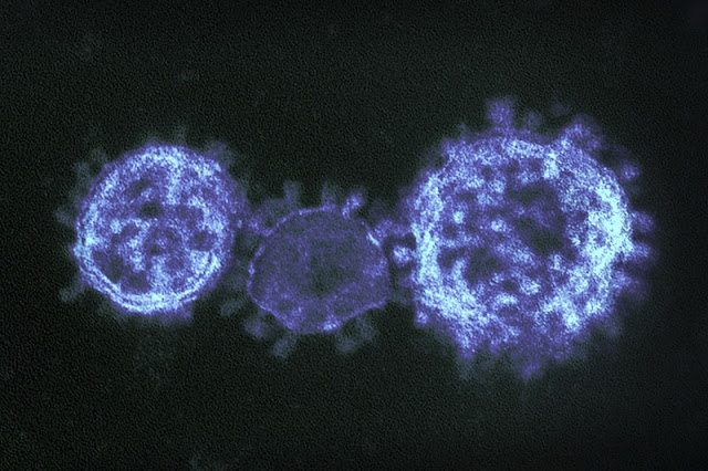 Coronavirus(COVID-19) spreads worldwide