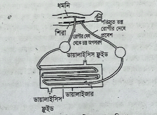 ডায়ালাইসিস প্রক্রিয়ায় রক্ত পরিশোধন