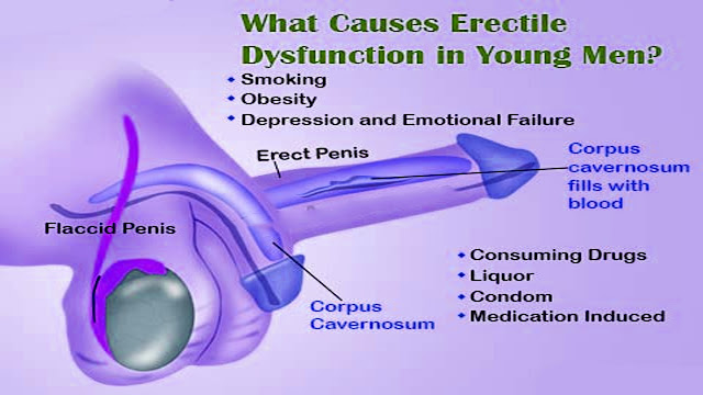 Erection is easy - Erectile Dysfunction cure at home - Hard core penis shaft - Do one thing