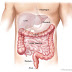 Tumor Usus Halus