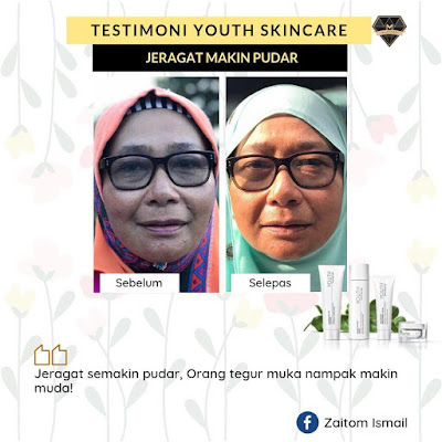 Testimoni Youth Skincare