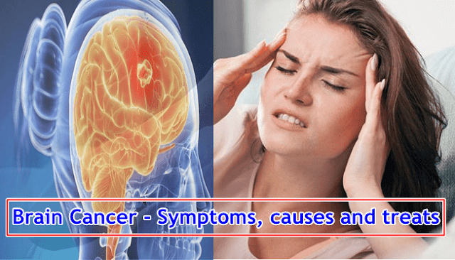 Brain Cancer - Symptoms, causes and treats