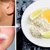 IN JUST 15 MINUTES, THESE 3 INGREDIENTS WILL REMOVE YOUR FACIAL HAIR FOREVER