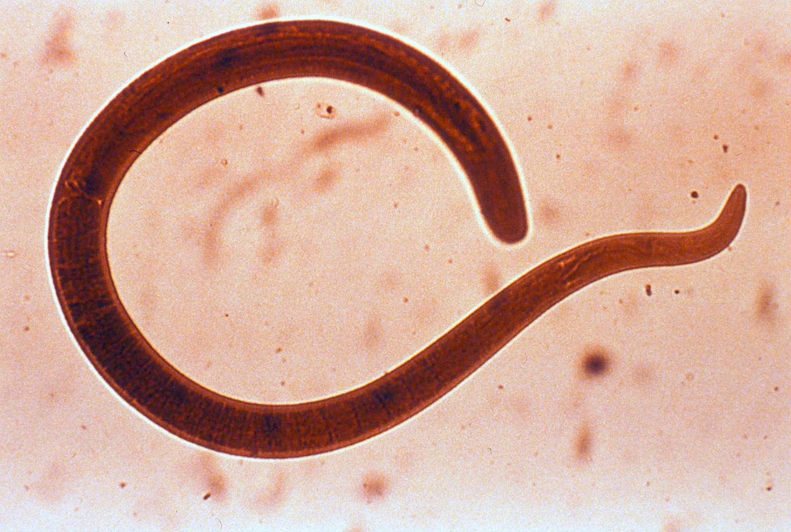 Tumbuhan Obat dan Sains Mengenal Cacing  parasit dalam 