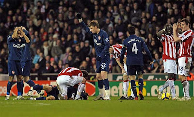 Aaron Ramsey is seen after sustaining a broken leg in a challenge with Ryan Shawcross