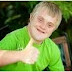 Kenali Lebih Dini Tanda-Tanda Down Syndrome  Pada Anak