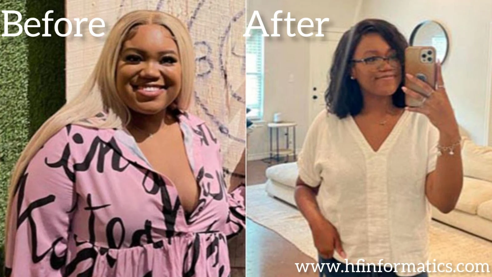 Mounjaro Weight Loss Before and After: