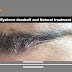 Eyebrow Dandruff and Natural Treatment : fitROSKY