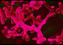 What is typhoid fever? What are the causes? How it can be diagnosed? How to prevent it? How to control typhoid fever at home?