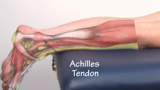 ACL Repair and Achilles Tendon Repair