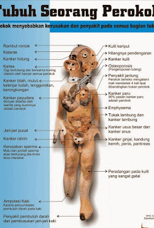 harga vivix shaklee, vivix shaklee diabetic, ubat sakit sendi, ubat diabetis, vivix testimonials, shaklee vivix testimonials, testimoni vivix shaklee, kebaikan vivix shaklee, kelebihan vivix shaklee, sembuhkan diabetis, petua awet muda, harga vivix shaklee, vivix shaklee diabetic, ubat sakit sendi, ubat diabetis, vivix testimonials, shaklee vivix testimonials, testimoni vivix shaklee, kebaikan vivix shaklee, kelebihan vivix shaklee, sembuhkan diabetis, petua awet muda, petua cantik ayu raudah, merawat SLE, menurunkan risiko kencing manis, tonik awet muda, membaiki DNA, vivix kanser, punca kanser, rawatan kanser, testimoni vivix, Vivix Testimonials, Vivix shaklee Testimonials