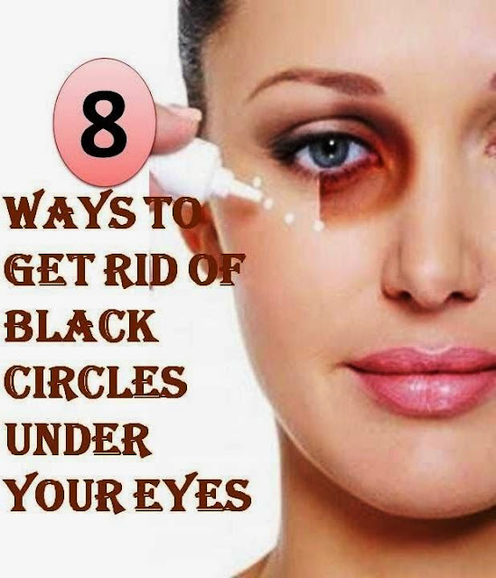 8 Ways To Get Rid of Black Circles Under Your Eye