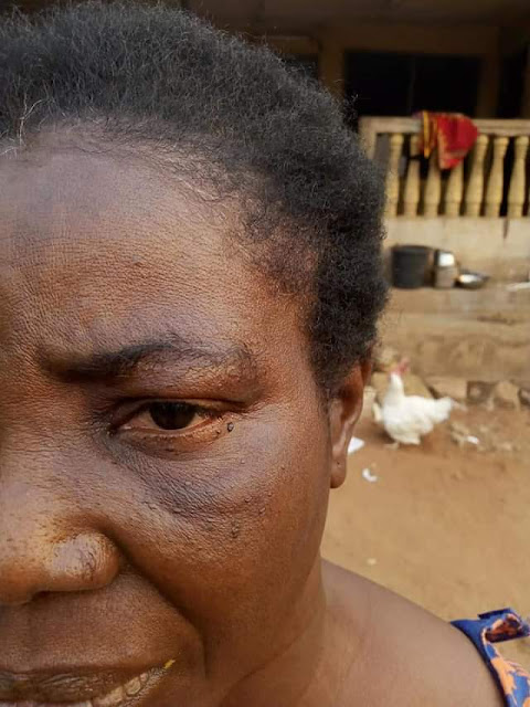 Photos: Anambra widow falls sick and dies after she was allegedly forced to drink a concoction by husband