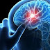 Η θεραπεία του καθρέφτη "ξυπνά"τους νευρώνες μετά απο εγκεφαλικό