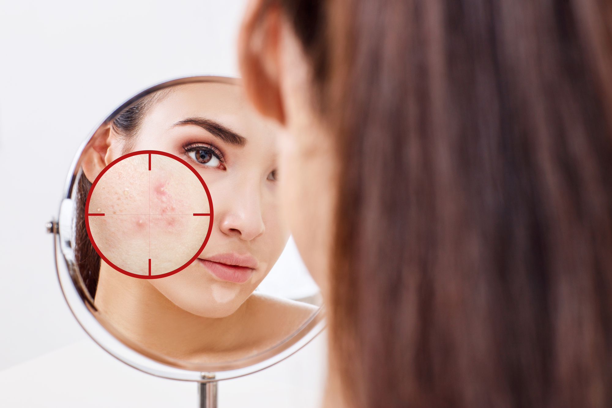A Comprehensive Guide to Getting Rid of Acne