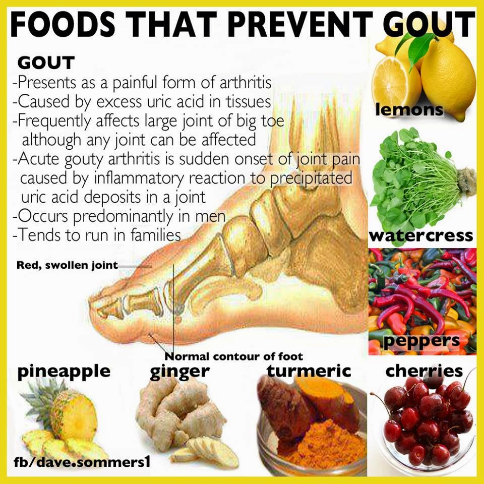 LeLaKi dAri GuNuNg: 7 Petua Untuk Mengurangkan Gout