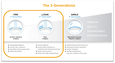 What exactly is a third generation laser? SMILE Laser Eye Surgery