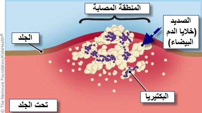 مكونات الخراج