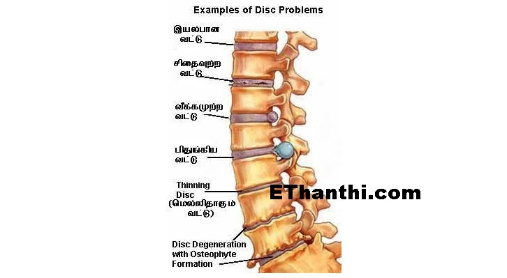 தோள்மூட்டு, புஜம், கைகளில் ஏற்படும் வலி !